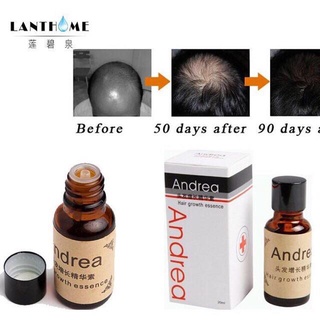 Hair and Scalp Conditioner▣✑✖Andrea hair growth essence