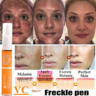 Instant Blemish Removal Gel Vitamin C Whitening Anti Freckle Cream Pen Effectively Remove The