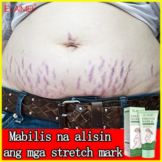Stretch Mark Stretch Mark Cream Stretch Marks Stretch Mark Lotion Oil for Stretch Marks (1)