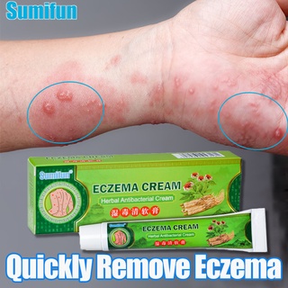 SUMIFUN Eczema Treatment Anti Eczema Cream Anti Fungal Ointment Ringworm and Fungal Ointment 20g