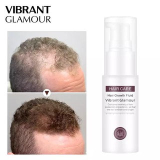 Hair Growth Fluid Spray Essence revent Hair Loss Preventing Baldness Consolidate Hair Hair Grower (1)