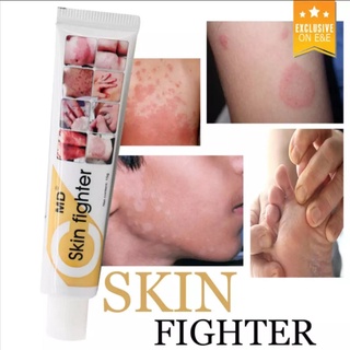 Skin Fighter Buy 1 Get 1 Eczema Ointment Cream skin lotion ointment cream for Allergy Skin Herbal