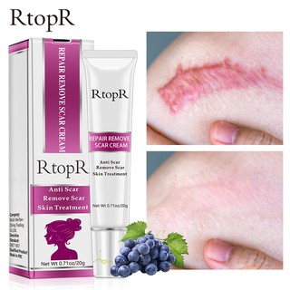 【Freemood】RtopR Scar Remover Gel Cream Acne Treatment Whitening Moisturizer Serum Skin Care Stretch Marks Remover Repair (1)