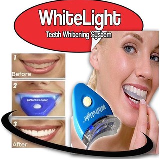 White Light Teeth Whitening