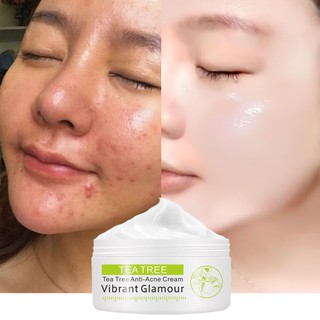 VIBRANT GLAMOUR Tea Tree Acne Cream Repair Set Face Cream Serum Remove Scar Acne Print Essence Oil