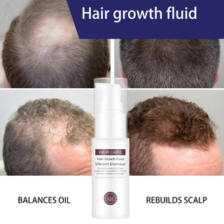 Hair Growth Fluid Spray Essence revent Hair Loss Preventing Baldness Consolidate Hair Hair Grower (1)