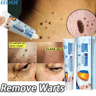 EELHOE Warts Remover Original Cream Natural Herbal Ingredients Warts Treatment Wart Removal Cream20g