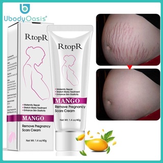 【New Arrival】UbodyOasis 40ml Mango Stretch Marks Remover Cream Eliminate Pregnancy Acne Scar Stretch Mark Anti-aging Anti-wrinkle Cream