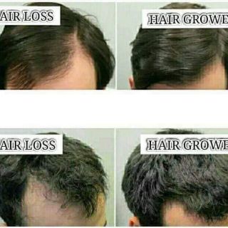 Prestige Extreme Hair Grower Shampoo & Conditioner (8)