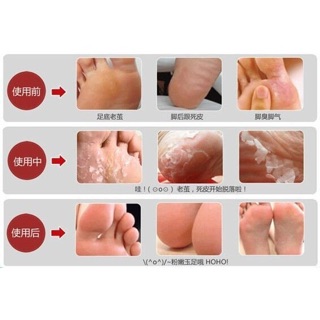 ✅COD/FREE SF❗️ PINX Foot Care Peeling Mask (7)