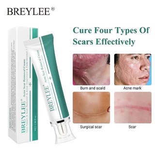 BREYLEE Scar Removal Cream Skin Care Face Cream For Face Acne Scar Stretch Remove Maternity