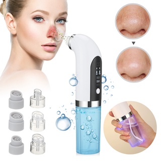【recommended】Blackhead Remover Nose Face Deep Cleaner Pore Acne Pimple Removal Vacuum Suction Facial