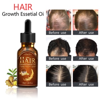 Ginseng hair growth liquid nourishes and prevents hair loss and promotes hair essential oil 30ml (1)