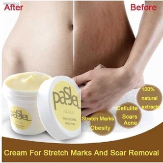❦✼Pasjel stretch mark scar whitening Cream 50g