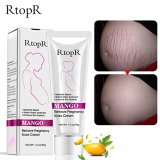 RtopR Mango Remove Pregnancy Scars Acne Cream Stretch Marks Treatment Maternity Repair Anti-Aging Sk