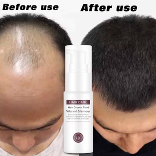 Hair Growth Fluid Spray Essence revent Hair Loss Preventing Baldness Consolidate Hair Grower