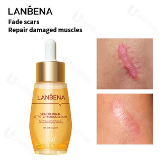 LANBENA Scar Removal Serum Stretch Marks Acne Treatment Anti Acne Shrink Pores Blackhead 20ml