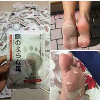 Onhand! Original Japan Foot Peeling Mask -Tanggal Kalyo