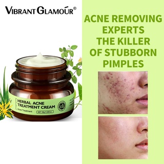 Herbal Anti Acne Treatment Serum Tea Tree Face Cream Scar Remover Gel Cream Pimple Removal Skin Care (1)